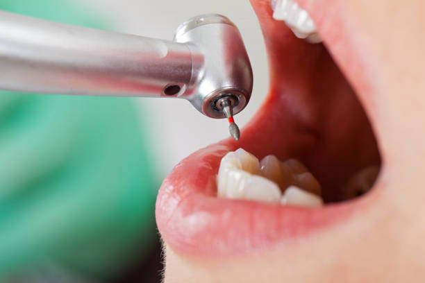 Best Tooth Infection Emergency Dentist  in Susanville, CA